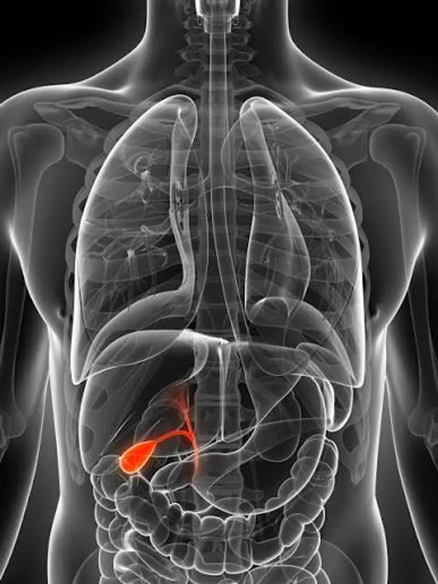 Keyhole gallbladder removal surgery