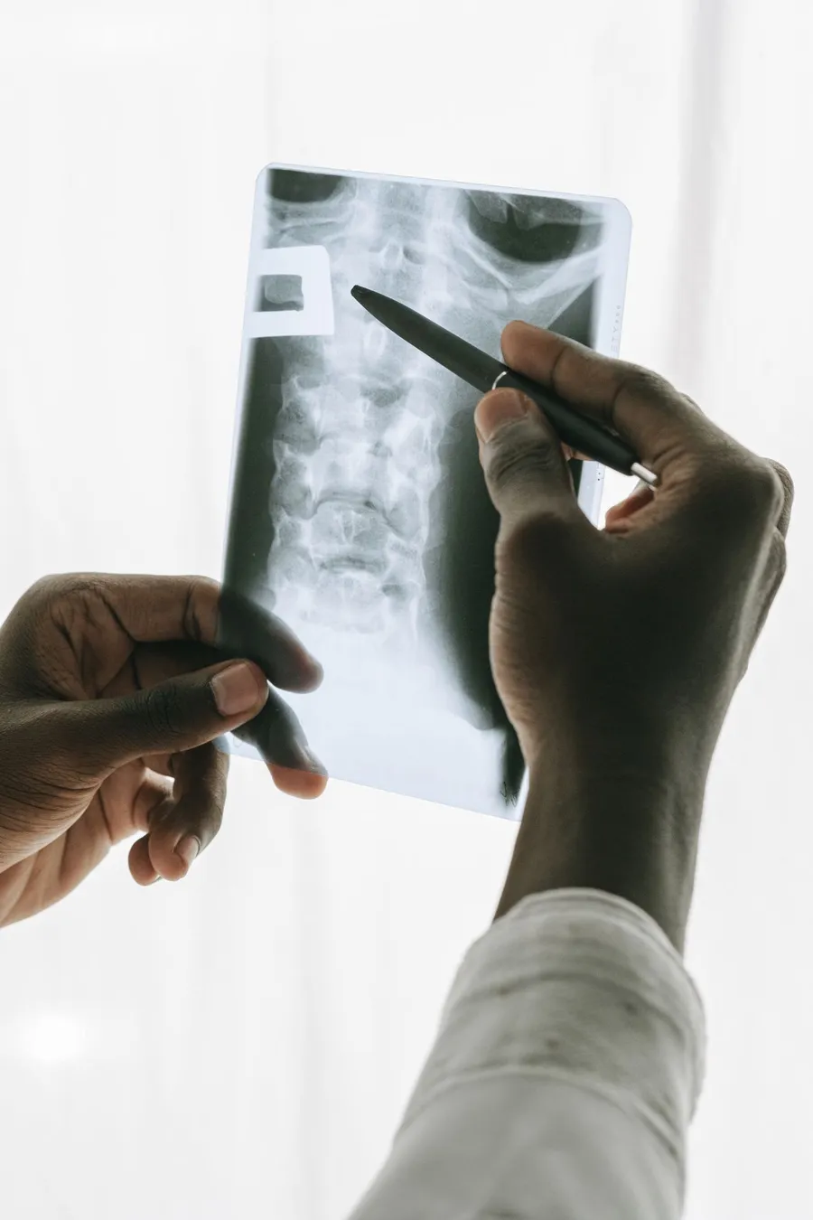 Treatment for thoracic outlet syndrome near the collarbone
